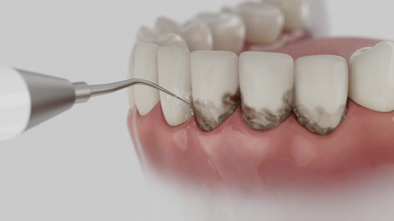 Reliable Dental contractor in Cleveland, MS by Dentist Open Now